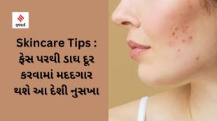 Skincare Tips : This tips will be helpful in removing blemishes from the face (unsplash)