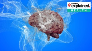 Alzheimer drugs