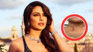 priyanka chopra | the bluff movie | priyanka chopra injury | priyanka chopra Instagram Story | priyanka chopra injured in the bluff