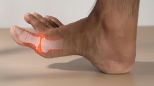 uric acid home remedies in gujarati