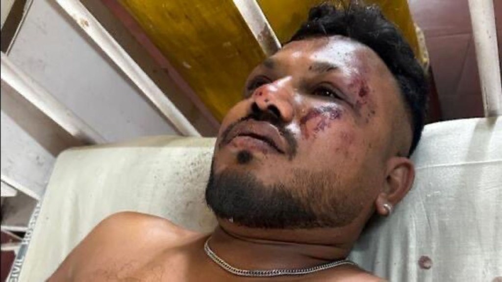 Ahmedabad plane crash Photo, Ahmedabad London plane crash Photo