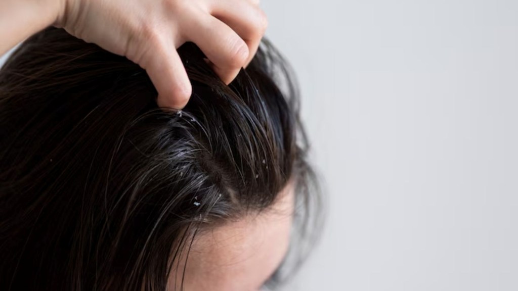 hair care in rain, hair care tips, ચોમાસાની ઋતુ