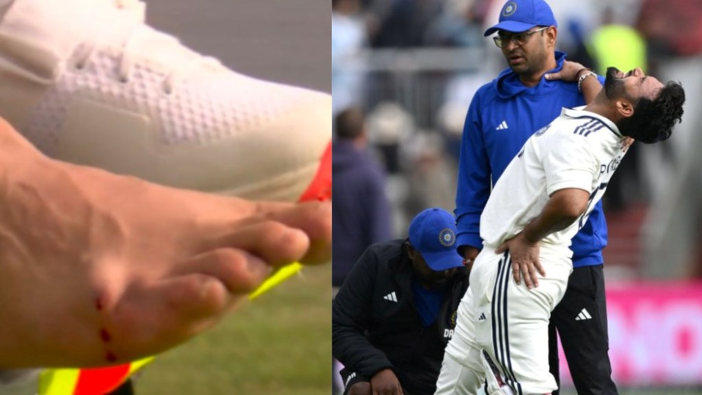 Rishabh Pant Injury, ઋષભ પંત ઇજા