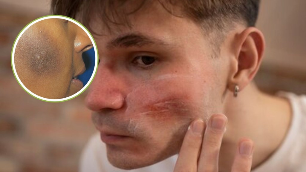 How To Remove Black Spots From Face